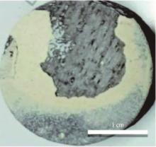 reducing heat accu